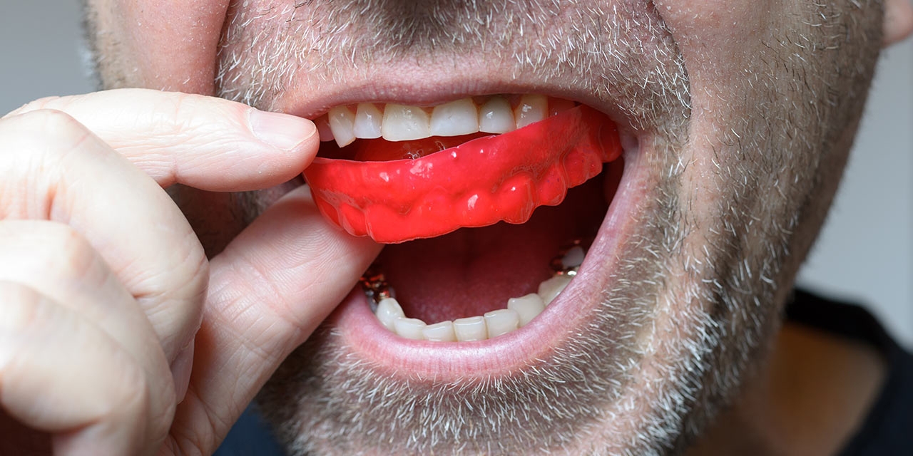 https://baysidedental.dreamhosters.com/wp-content/uploads/2017/06/red-mouthguard-1.jpg